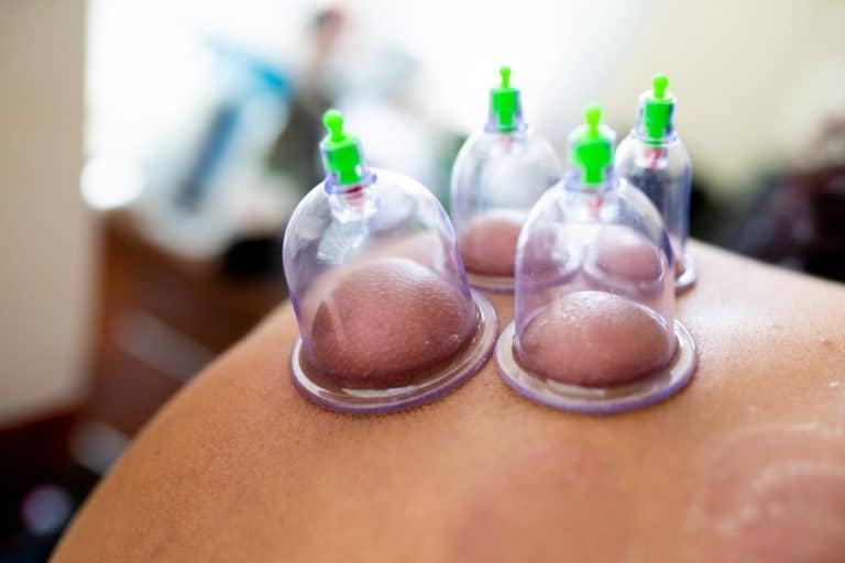 hijama tete