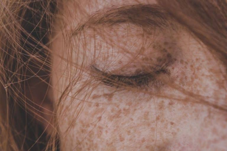 taches de rousseur feminine